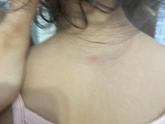 Аллергия или что?