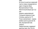 Первое УЗИ
