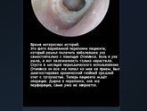Отипакс и иже с ним