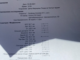 Ахондроплазия