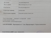 Сходила на узи!