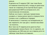 Ахондроплазия