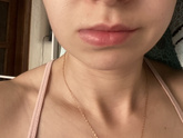 Опухла губа