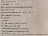 19 неделя