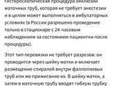 Кто-нибудь перевязывал трубы после естественных родов?