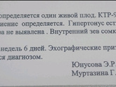 Похоже в эту Б