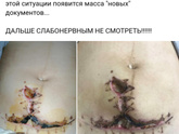 Смотрю про домашние роды