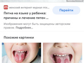 Пятно на языке у