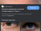 У сына на щеке