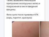 Прививка корь, краснуха, паратит как перенесли?