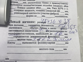 У меня спкя более