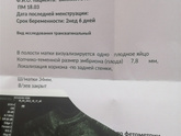 Не увидели плодное яйцо 🤬