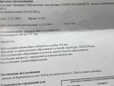 уЗИ киста ЖТ