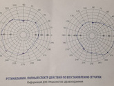 Эндокринолог отправил к офтальмологу