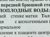 УЗИ