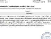 Результаты хгч