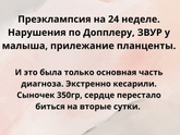 Я потеряла своего первого малыша, может мне станет легче, если поделиться