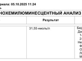 ЭКО (4 дпп)