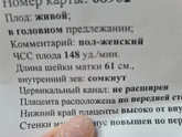 Сходила на узи написали,