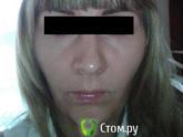 Хочу брекеты очень ,