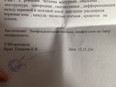 Вот что с моими лимфоузлами