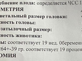 Вес и размер плода