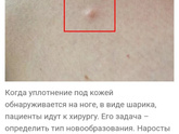Уплотнение на ноге