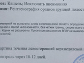 Первый раз какой-то намёк на пневмонию, даже в детстве не бывало