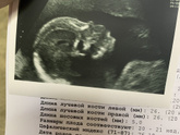 Была на узи в центре патологий (к пред посту)