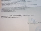 узи