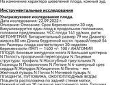 Кто сталкивался с ассиметричной