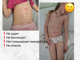 Что за вирус?