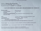 Вот и сходила на узи?