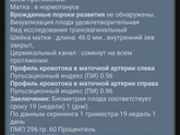 Кто делал второй скрининг в 19 недель ровно?