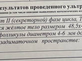 Фолликулометрия и овуляция