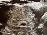 🤰😍❤️🫶🏼