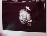 35 недель 🤰
