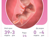 Сходила к гинекологу, сказали