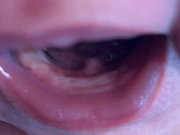 Зубы