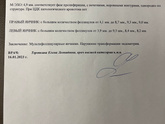 Фолликулометрия 11 дц