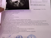 Я в шоке мягко говоря ( узи ) 🩵