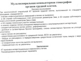 Кт лёгких
