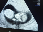 🤰Первый скрининг 🤰