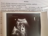 Двойняшки???!!!!!😍