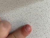 Что не так с этим пальцем?
