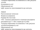 Расширена лоханка почки у