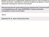 Помогите расшифровать гистологию