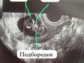 Короче!