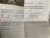 Привет девочки.
