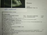 Внутриматочная перегородка.